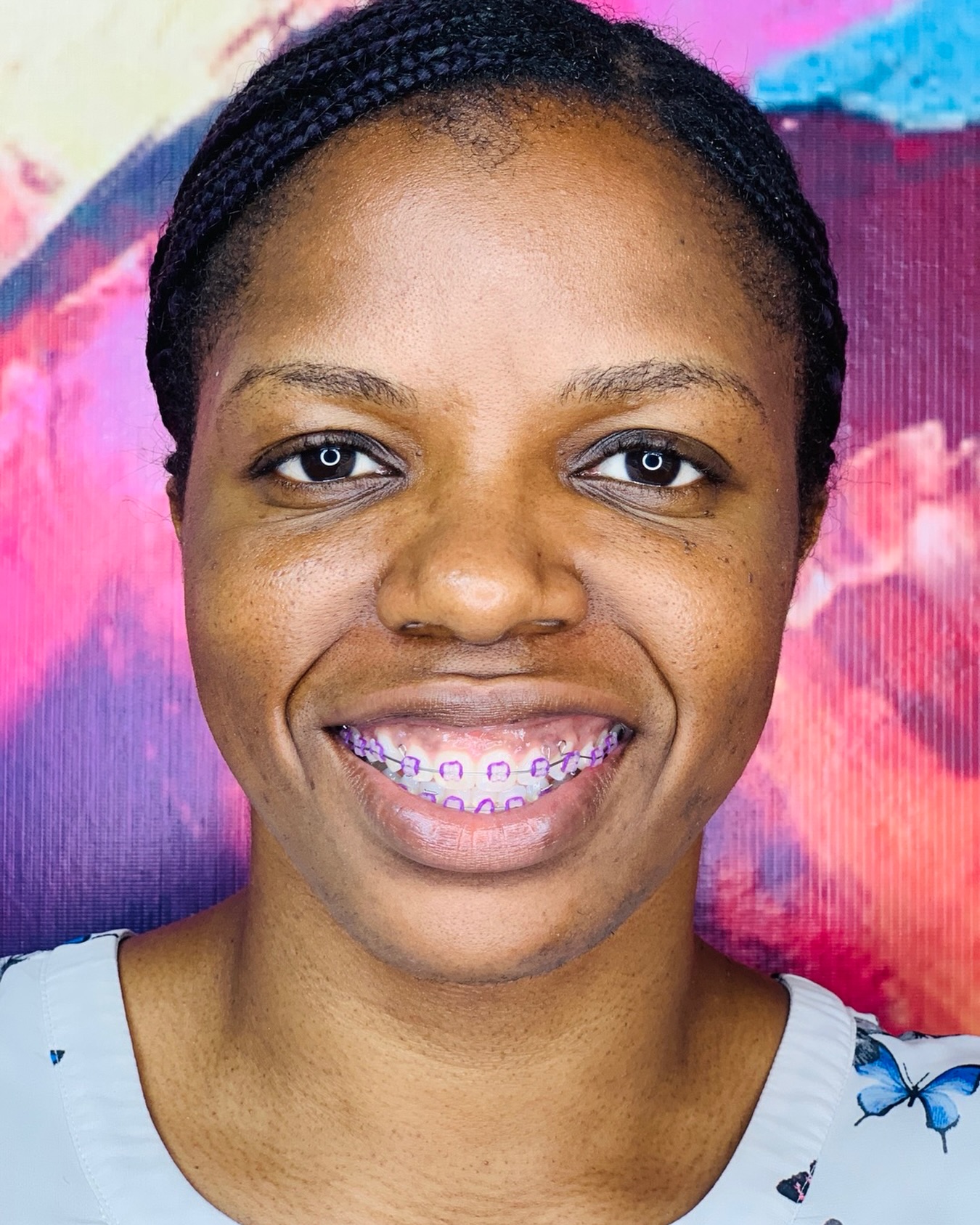Orthodontist adjusting fixed braces on a patient
